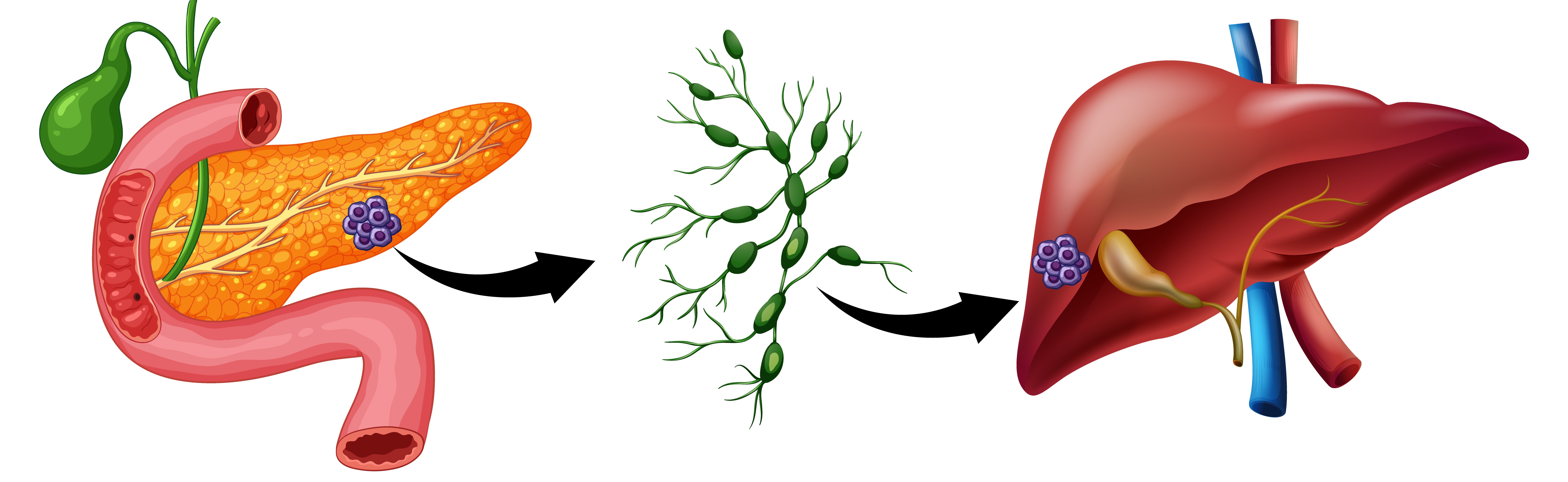 Ayurvedic liver treatment